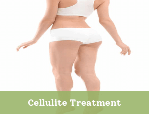 Cellulite Treatment