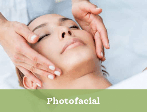 Photofacial