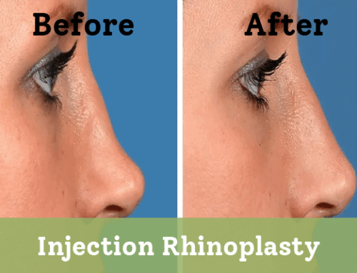 Injection Rhinoplasty