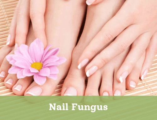 Nail Fungus