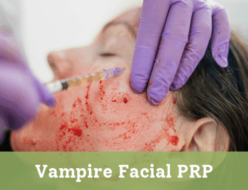 Vampire Facial PRP