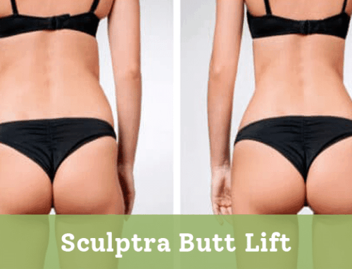 Sculptra Butt Lift