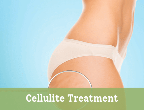 Cellulite Treatment
