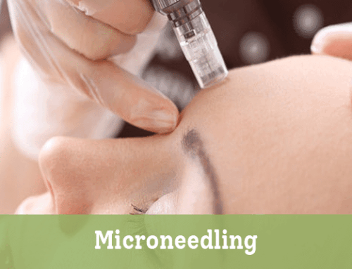Microneedling