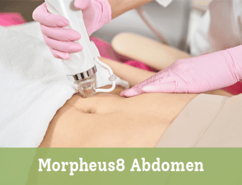 Morpheus8 Abdomen