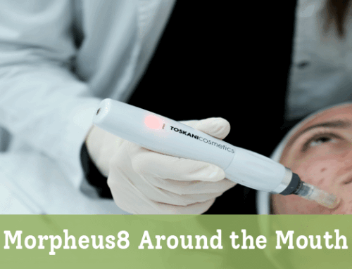 Morpheus8 Around the Mouth