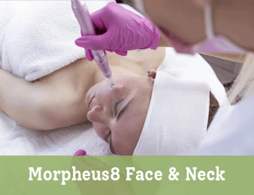Morpheus8 Face & Neck