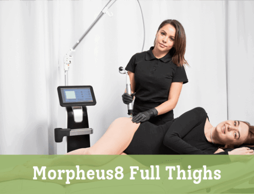 Morpheus8 Full Thighs