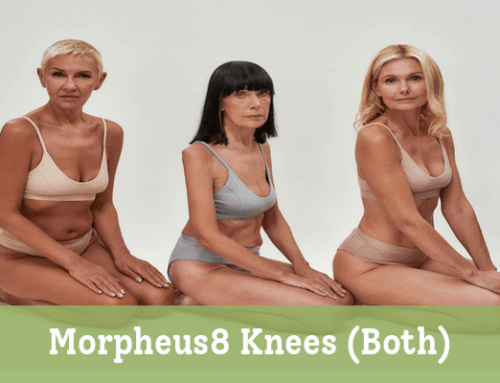 Morpheus8 Knees (Both)