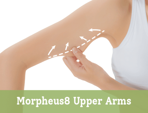 Morpheus8 Upper Arms